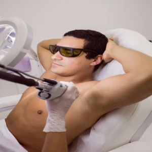 Laser Hair Removal for Men in Dubai