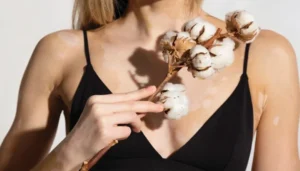 هل يوجد علاج للبهاق؟ علاج البهاق نهائيا في ساعة