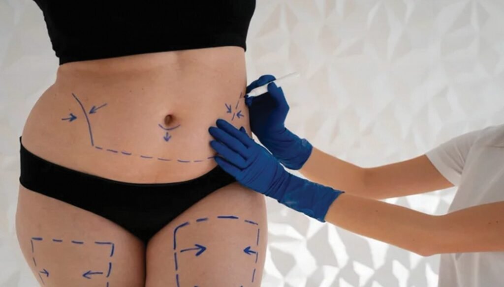 الفرق بين نحت الجسم وشفط الدهون 17 84