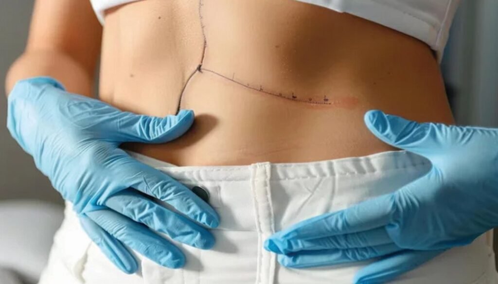 سعر عملية شد البطن في دبي