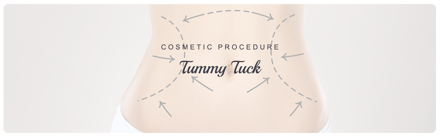 Tummy Tuck