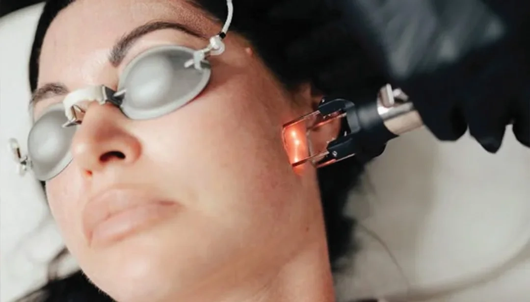 إزالة الندبات بالليزر في دبي لبشرة أكثر حيوية