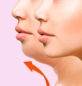 740b2aef61ada2a04161dc60ed0720e5 1