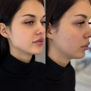 795924ae1b729961946cef3538b008c6 1