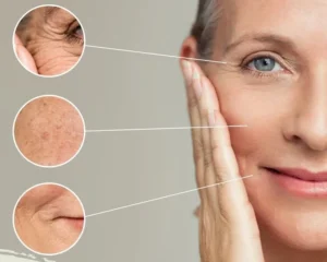 افضل دكتور تجميل في دبي حصة بن حيدر