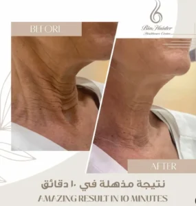أفضل مراكز التجميل في دبي الامارات للعناية بجمالك