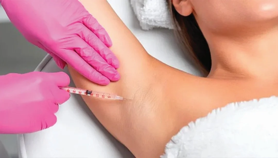 مقالات 135 حقن البوتوكس لعلاج فرط التعرق في دبي