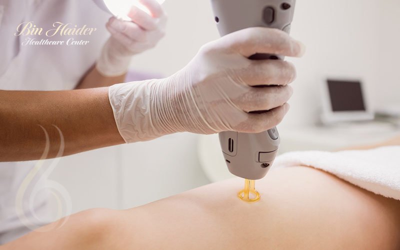 laser hair removal near me