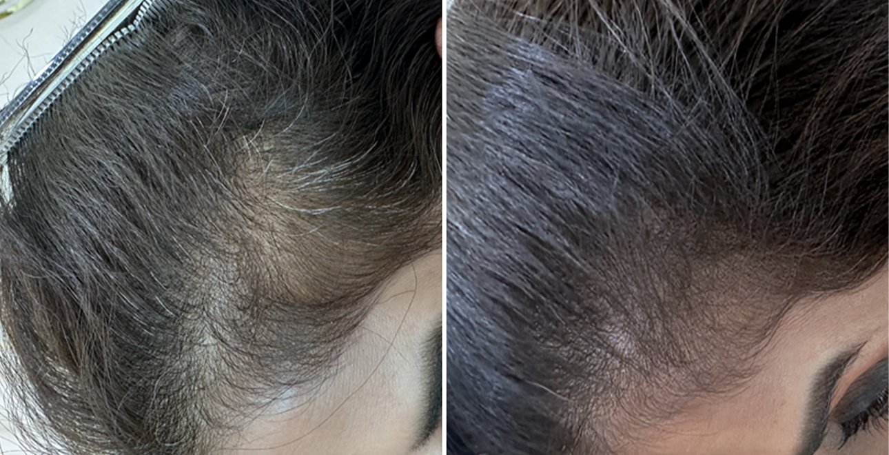 Hair3