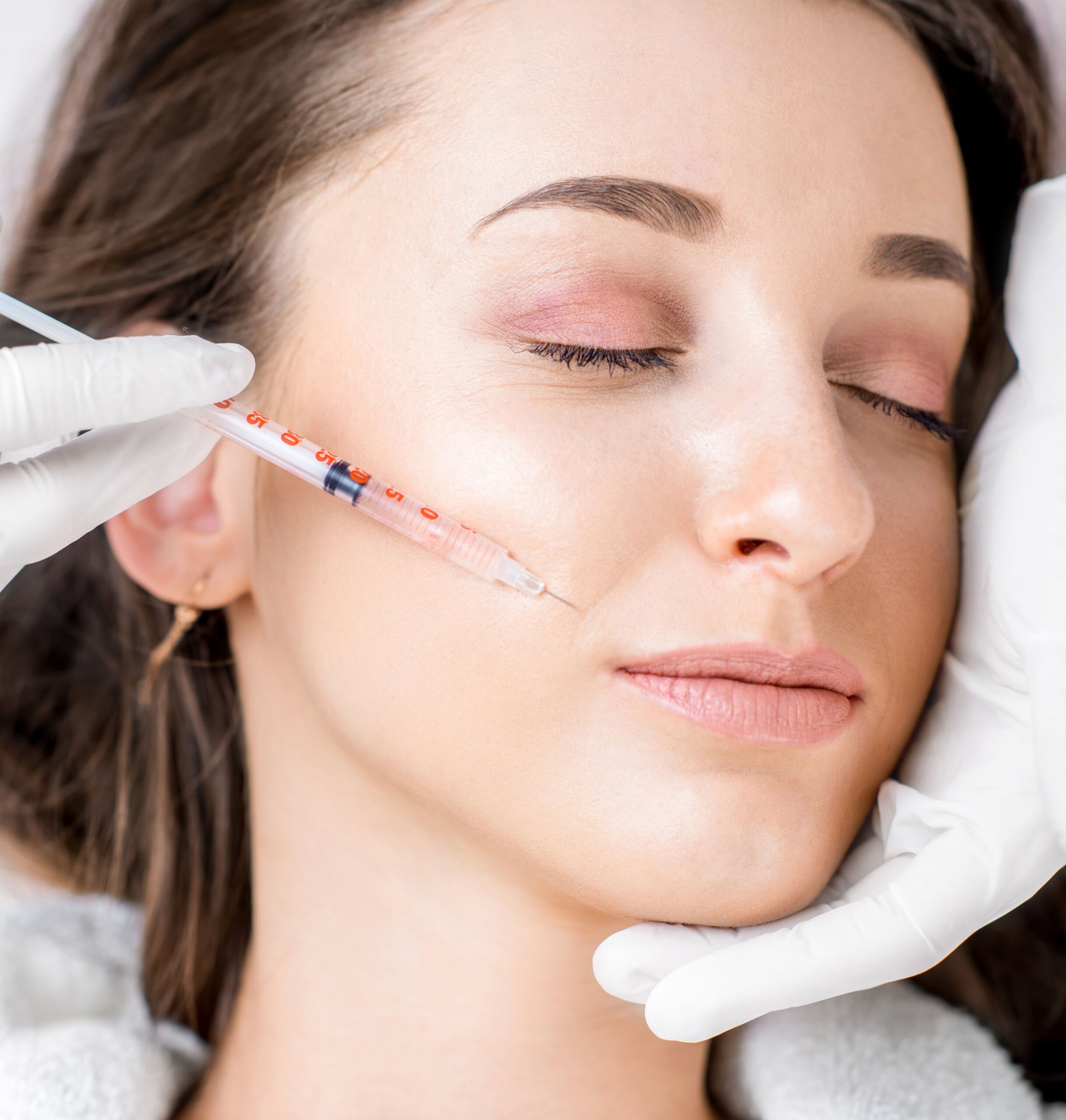 dermal filler